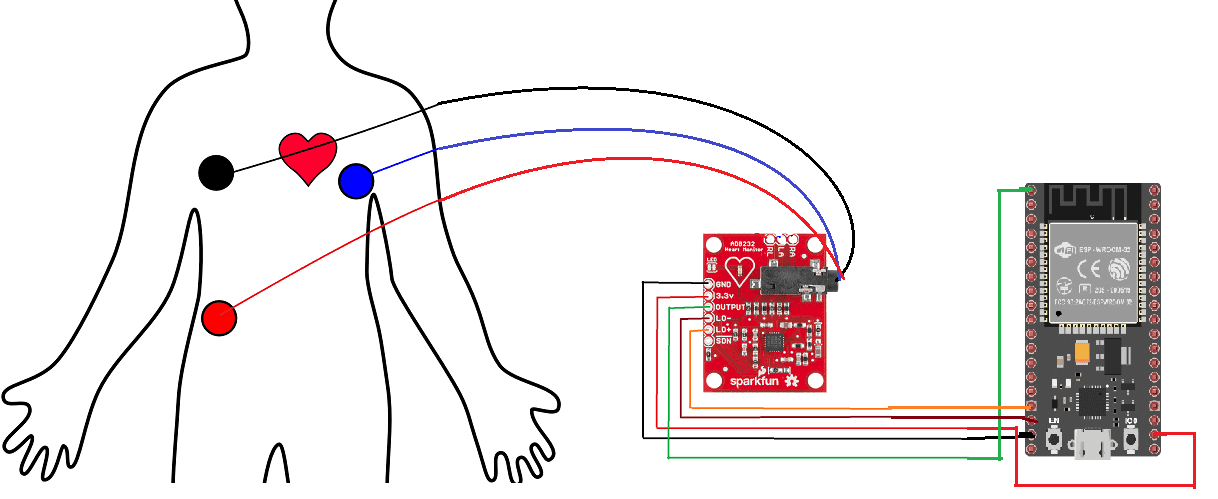 ecg-iot